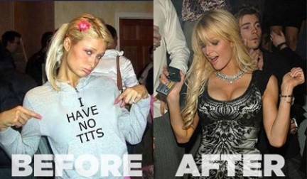 Paris Hilton prima e dopo